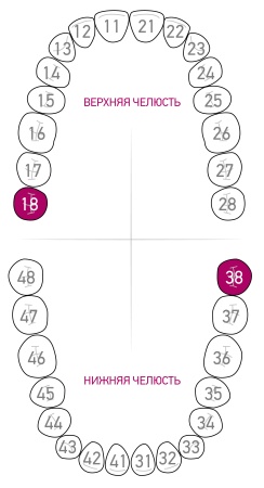 Кламп для коффердама Dentech (Япония) 13А